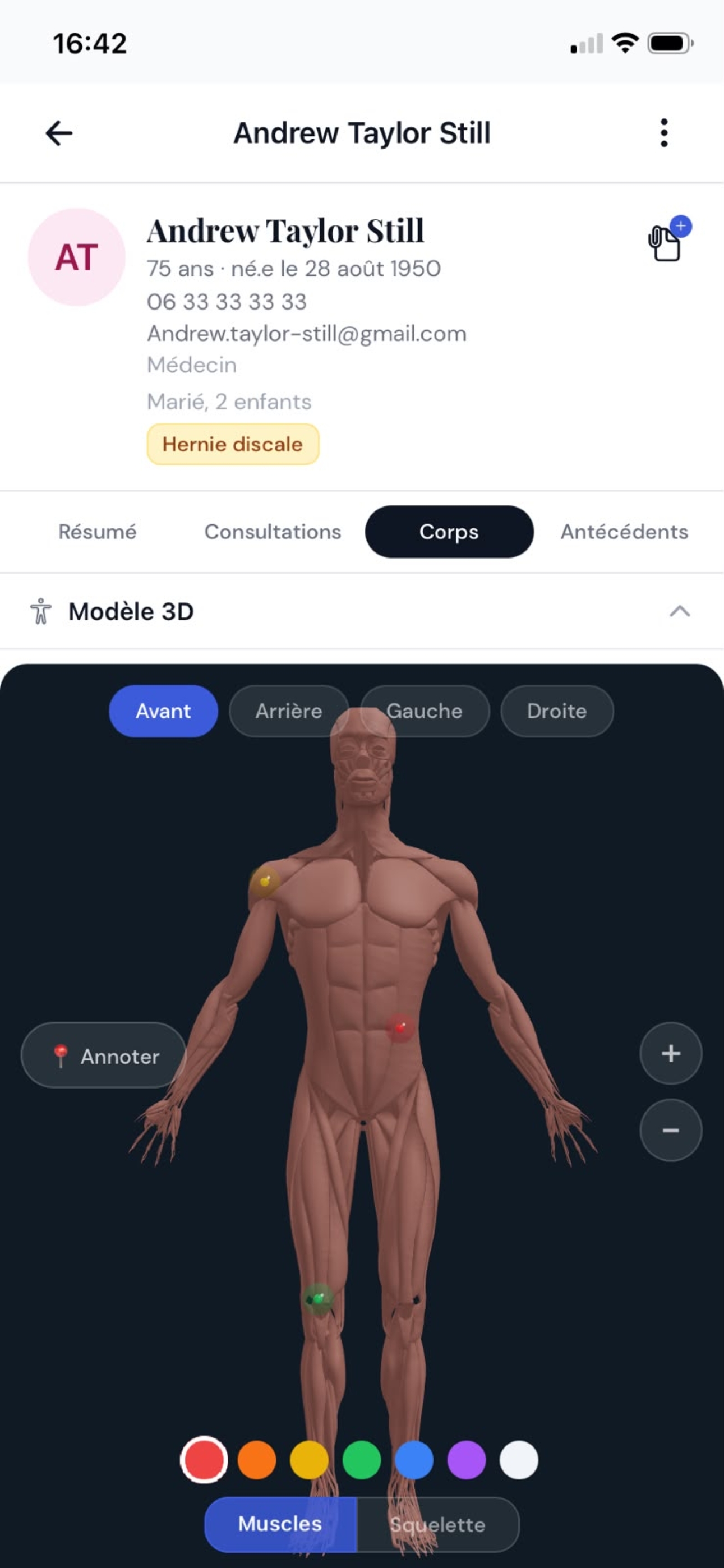 Analyse assistée par IA dans MyOsteo