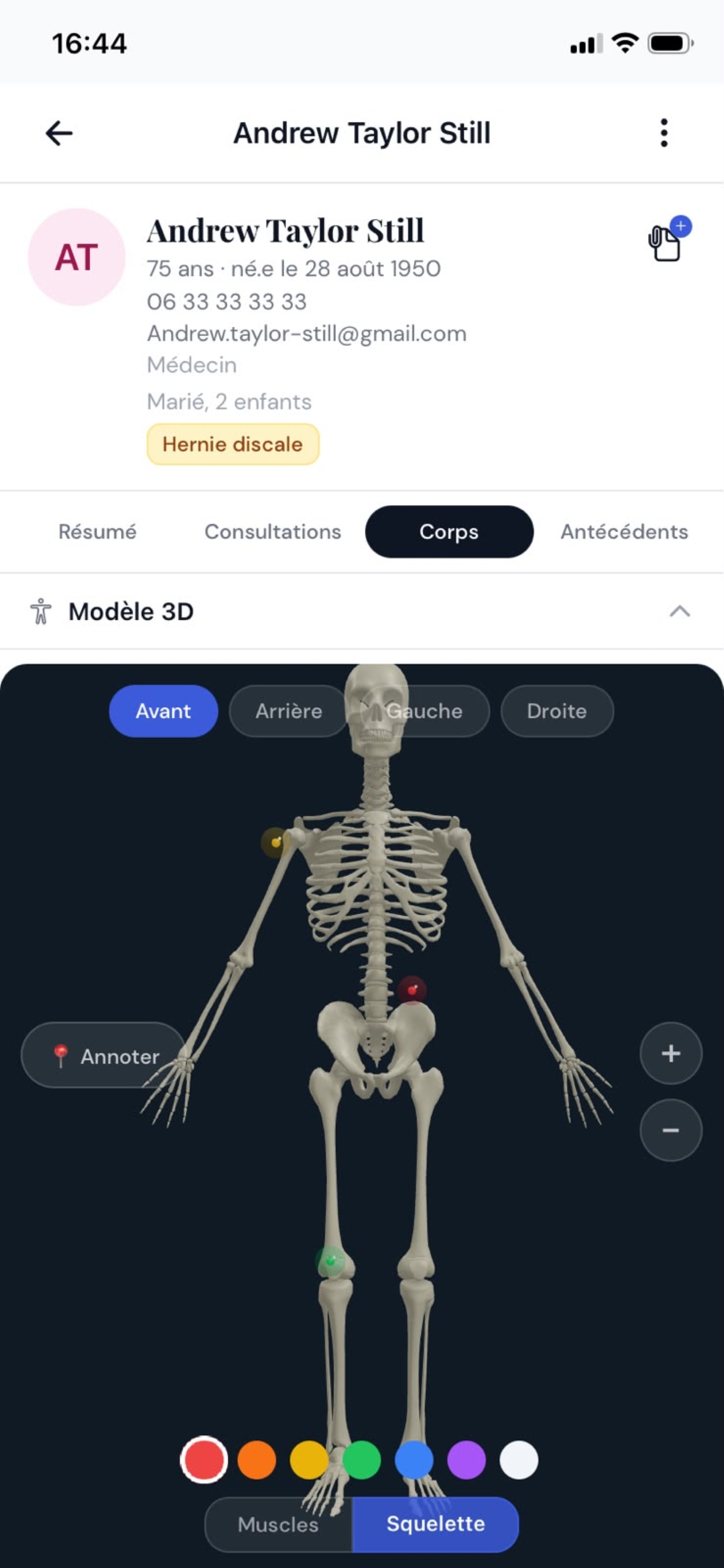Schéma anatomique 3D dans MyOsteo